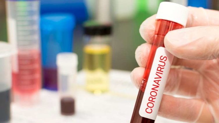 COVID-19: Saiba quais tecnologias podem prevenir epidemias como o coronavírus